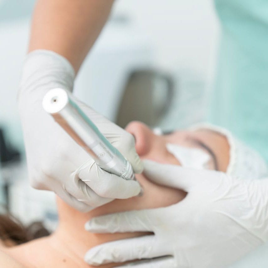 Microneedling  Microneedling